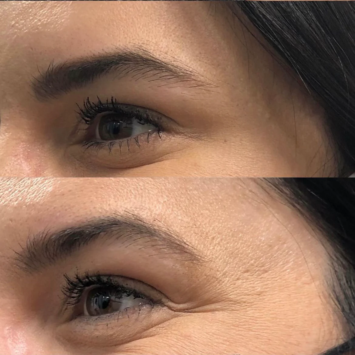 Crows Feet - Image 3