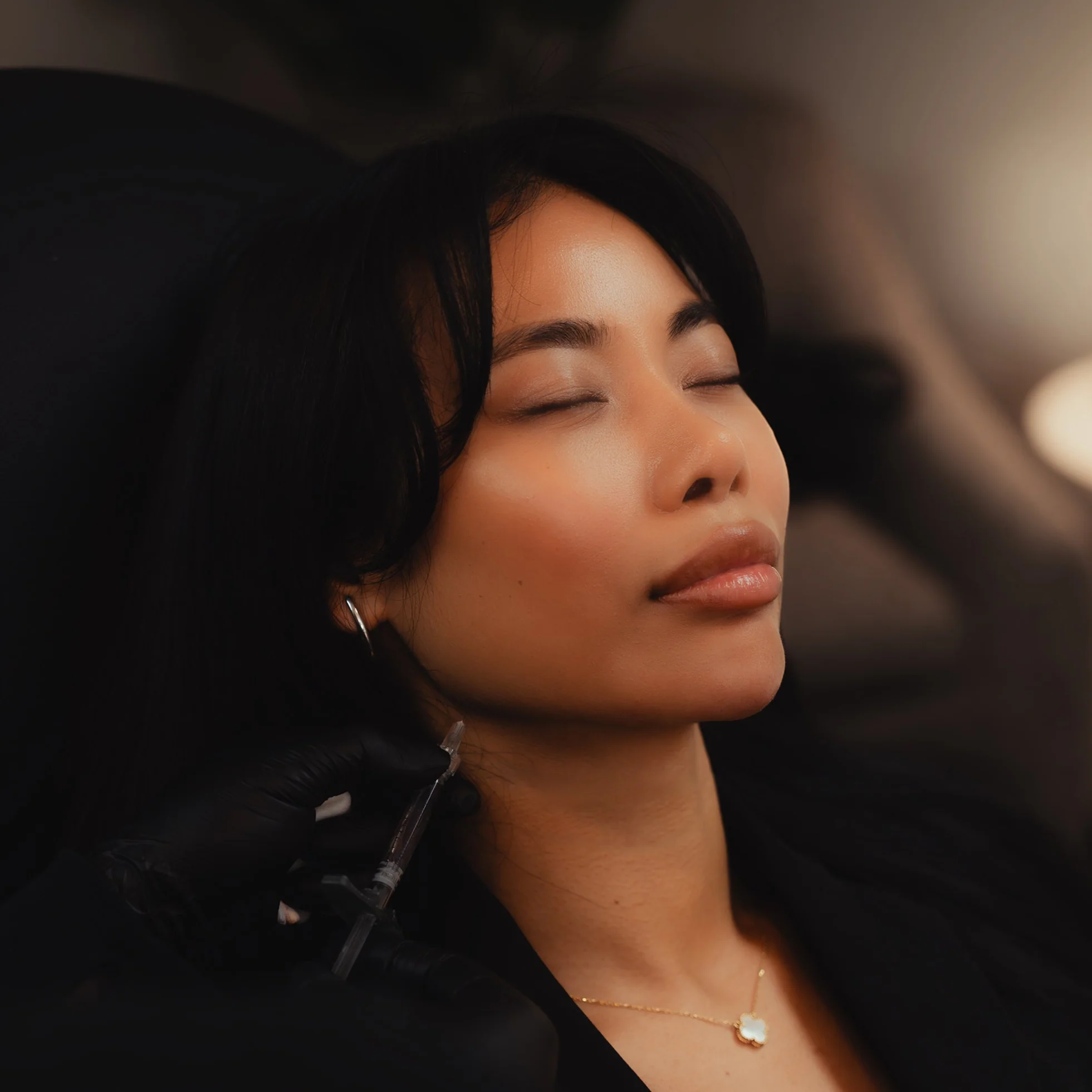 Jawline Contour Filler - Image 3