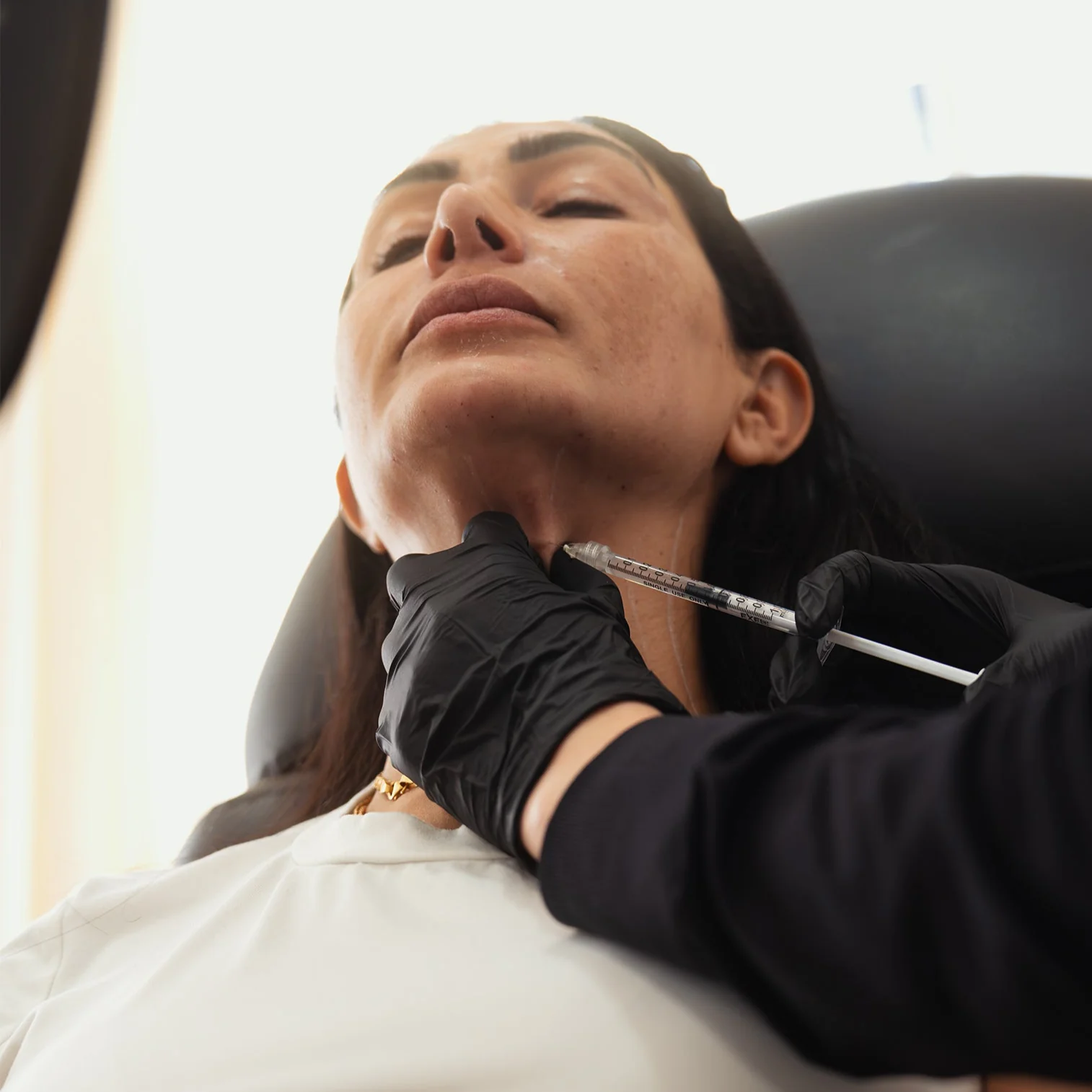 HyperDiluted Neck Filler | Radiesse - Image 3