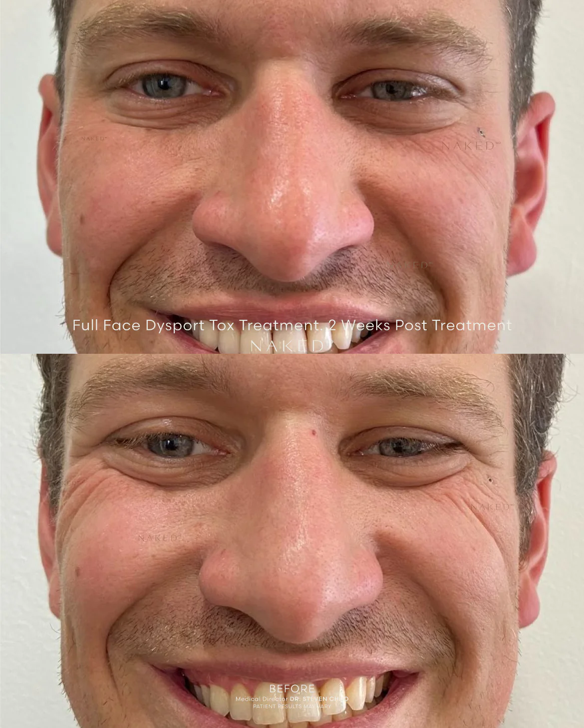 Naked TOX | Neurotoxins - Image 7