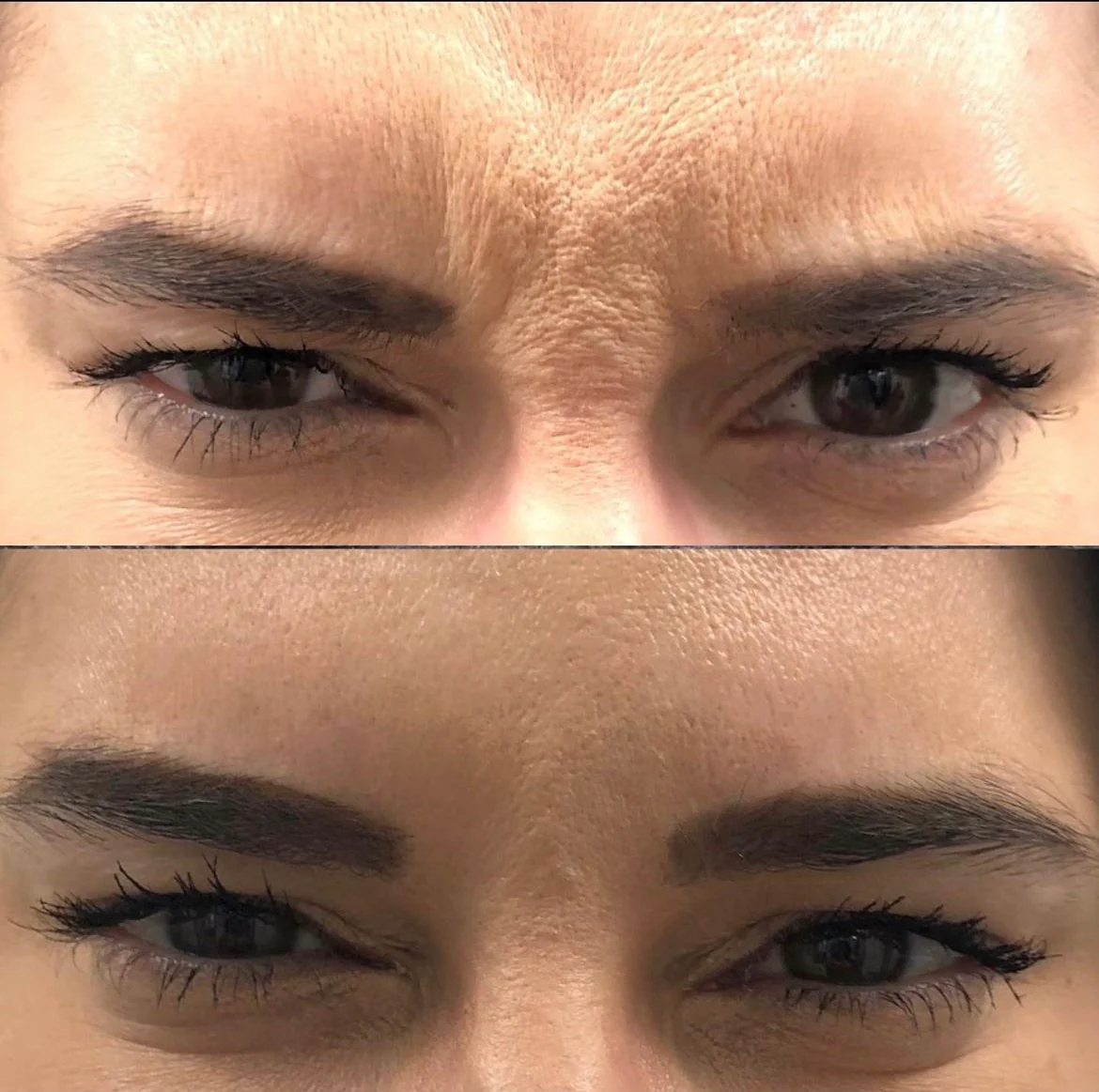 Naked TOX | Neurotoxins - Image 8