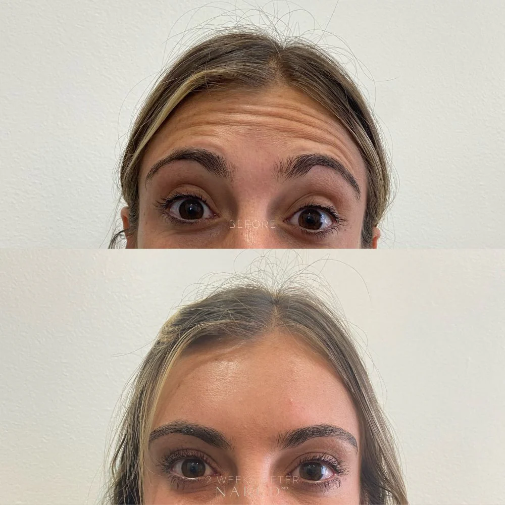 Naked TOX | Neurotoxins - Image 10