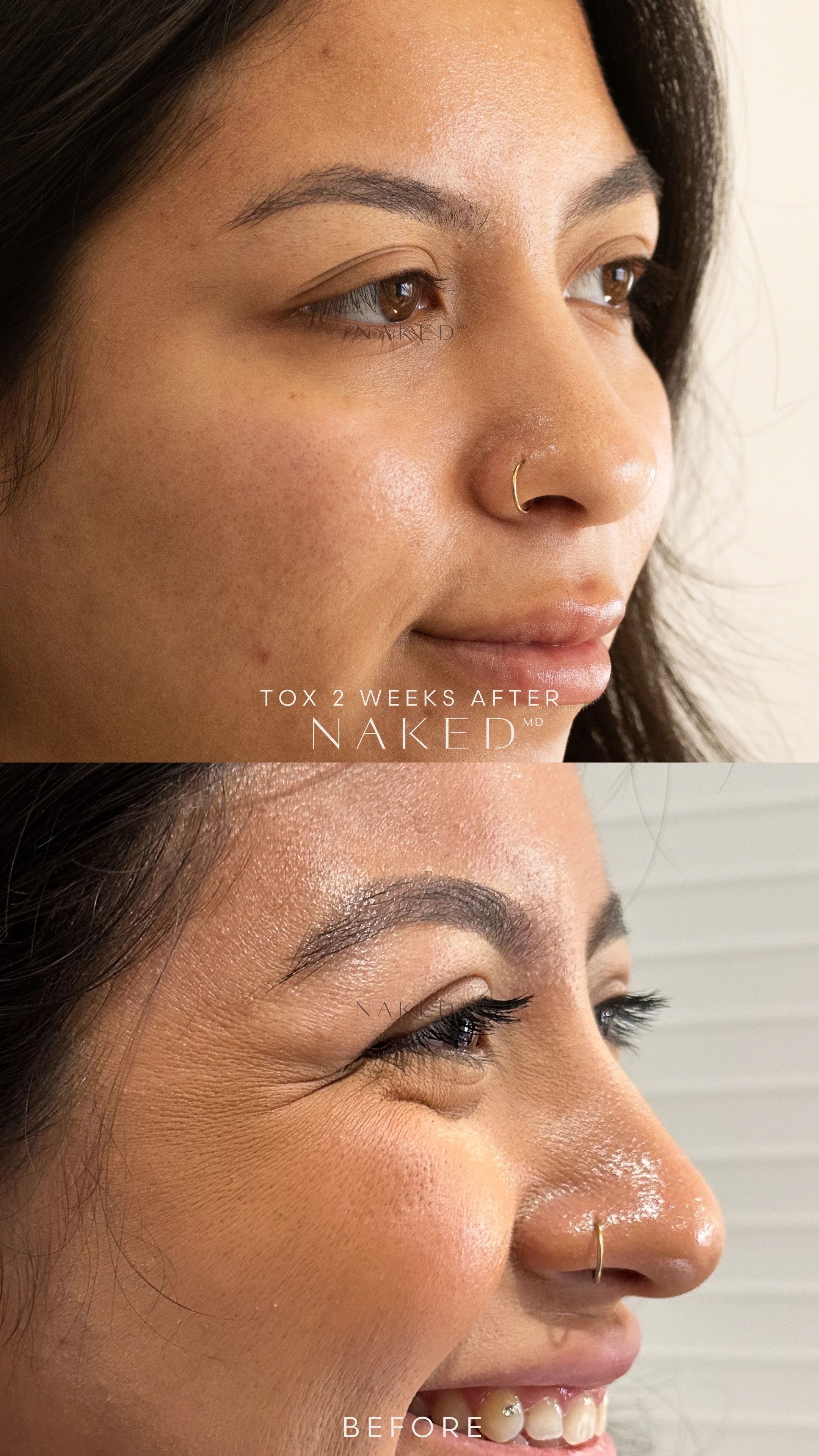 Naked TOX | Neurotoxins - Image 11