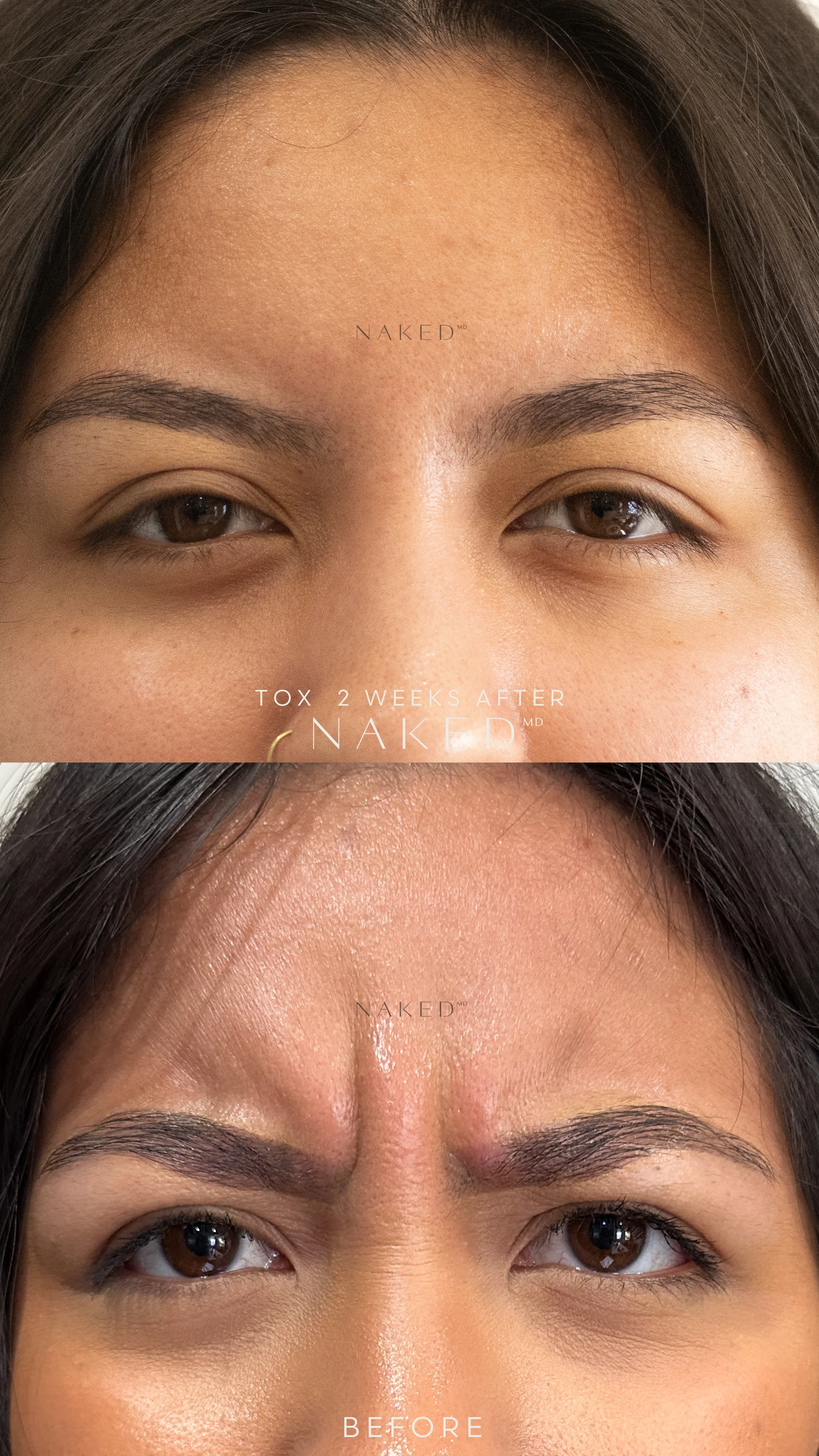 Naked TOX | Neurotoxins - Image 13