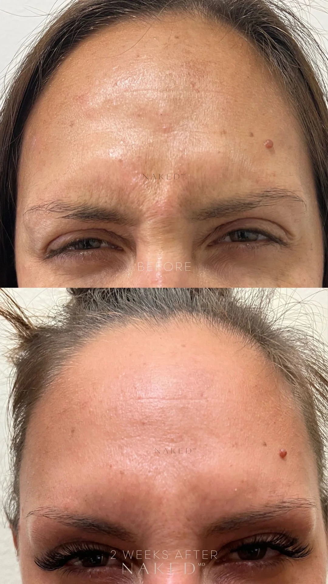 Naked TOX | Neurotoxins - Image 5