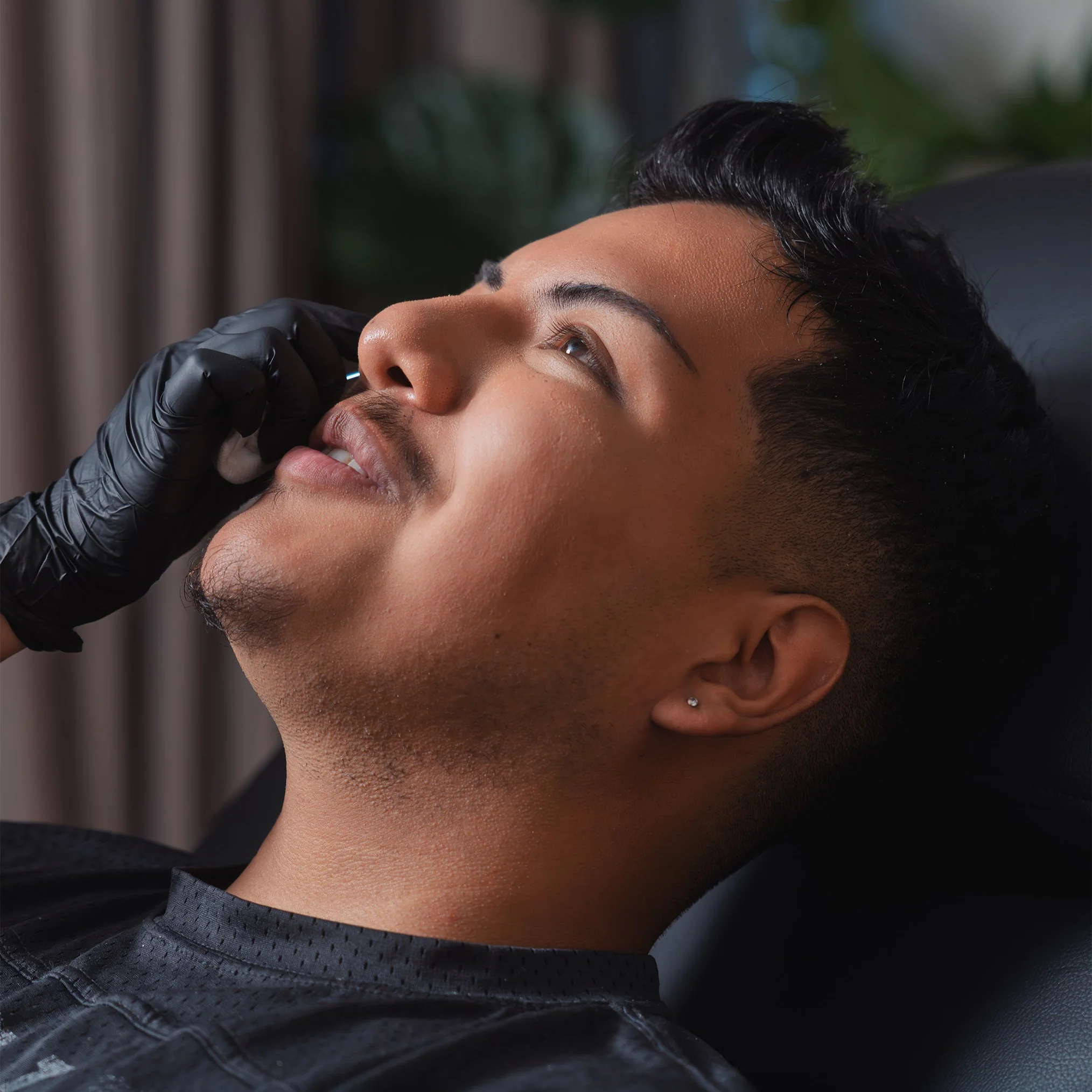 Undereye Filler - Image 3